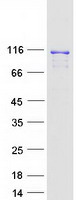 Coomassie blue staining of purified RAI14 protein