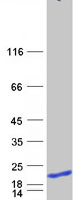 protq9p0r6 hspc210 gskip human recombinant protein