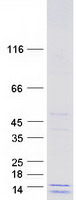 Coomassie blue staining of purified COX16 protein