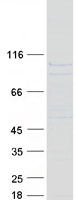 protq9p0w8 spata7 human recombinant protein