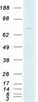 protq9p286 pak5 human recombinant protein