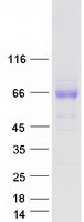 Coomassie blue staining of purified TMEM181 protein