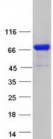Coomassie blue staining of purified KLHL14 protein
