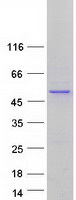 protq9p2j9 pdp2 human recombinant protein