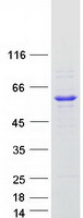 Coomassie blue staining of purified KLHL42 protein