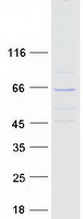 protq9p2n7 klhl13 human recombinant protein
