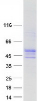 protq9p2s5 wdr8 wrap73 human recombinant protein