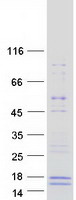 Coomassie blue staining of purified GALP protein