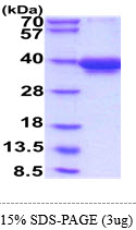 3ug by SDS-PAGE under reducing condition and visualized by coomassie blue stain