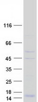 protq9ubk5 hcst human recombinant protein