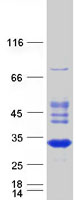 Coomassie blue staining of purified RABL2A protein