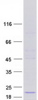 protq9ubk9 uxt human recombinant protein
