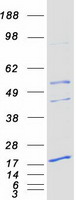 Coomassie blue staining of purified PEMT protein
