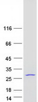 Coomassie blue staining of purified EIF3K protein