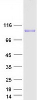 Coomassie blue staining of purified ADD3 protein