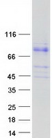 protq9ufc0 lrwd1 human recombinant protein