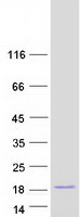 protq9ufg5 c19orf25 human recombinant protein