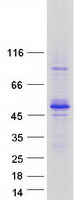 Coomassie blue staining of purified TES protein