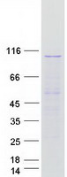 protq9ugp8 sec63 human recombinant protein