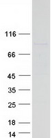 protq9uh90 fbxo40 human recombinant protein