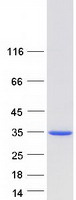 protq9uh92 mlx human recombinant protein
