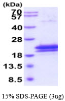 3ug by SDS-PAGE under reducing condition and visualized by coomassie blue stain