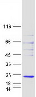 Coomassie blue staining of purified TCEAL9 protein