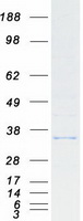 Coomassie blue staining of purified CYB5R1 protein