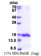 protq9uhv8 sdspage human lgals13 recombinant protein