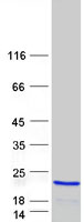 protq9uhv9 pfdn2 human recombinant protein