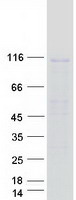 protq9ui26 ipo11 human recombinant protein