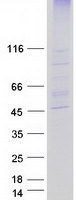 Coomassie blue staining of purified ZDHHC2 protein