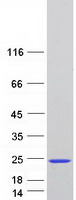protq9uil1 scoc human recombinant protein