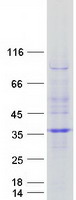 Coomassie blue staining of purified RWDD2A protein