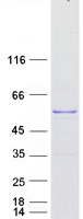 protq9uj04 tspyl4 human recombinant protein