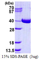 3ug by SDS-PAGE under reducing condition and visualized by coomassie blue stain