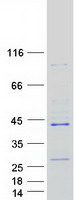 Coomassie blue staining of purified RPUSD1 protein