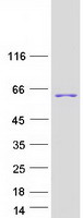 protq9uju6 hip55 dbnl human recombinant protein
