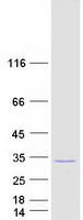 protq9uk41 vps28 human recombinant protein