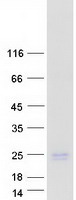 Coomassie blue staining of purified JPT1 protein