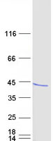 protq9uka8 calcipressin 3 rcan3 human recombinant protein