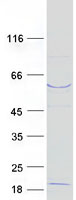 protq9ukb1 beta trcp2 fbxw11 human recombinant protein