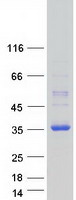 protq9ukb3 dnajc12 human recombinant protein