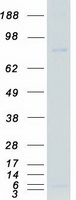 protq9uki8 tlk1 human recombinant protein