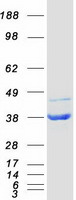 protq9ukk9 nudt5 human recombinant protein