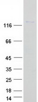 protq9ukp5 adamts6 human recombinant protein