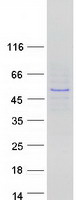 Coomassie blue staining of purified IKZF3 protein
