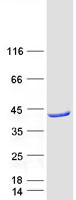 Coomassie blue staining of purified ACAD8 protein