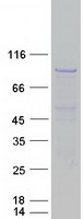 protq9ukv0 hdac9 human recombinant protein