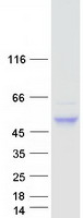 Coomassie blue staining of purified CNOT11 protein